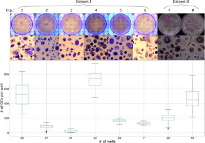 Automated Quantification of Human Osteoclasts Using Object Detection